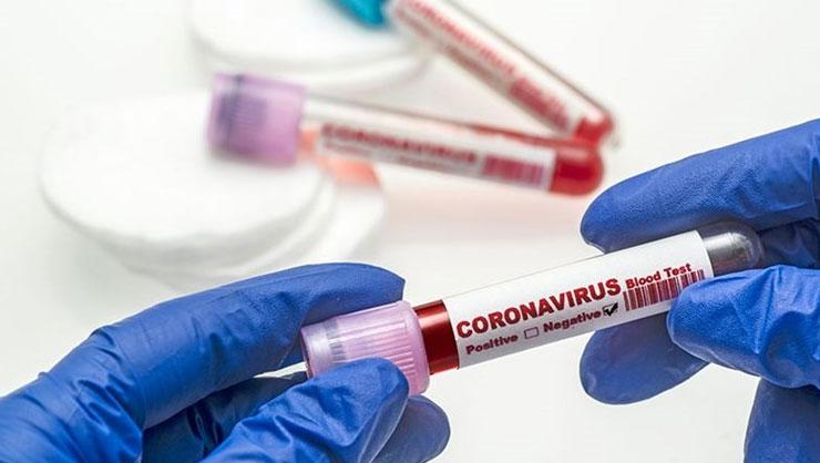 26 Şubat koronavirüs tablosu